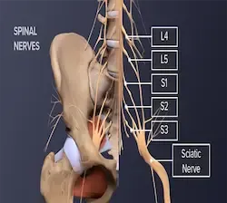 isijalgija, manuelna terapija pravdic-beograd