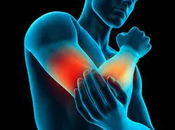 teniski lakat simptomi, manuelna terapija pravdic-beograd